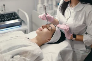 microneedling in Alexandria, VA